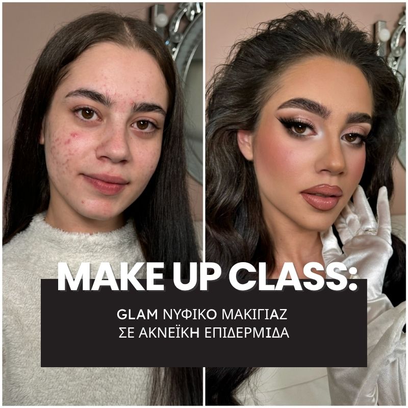 Glam Νυφικό Μακιγιάζ σε Ακνεϊκή Επιδερμίδα